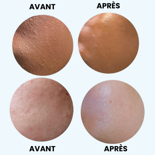 Gelée Nettoyante Douce – Peau Sensible & Éclat Naturel