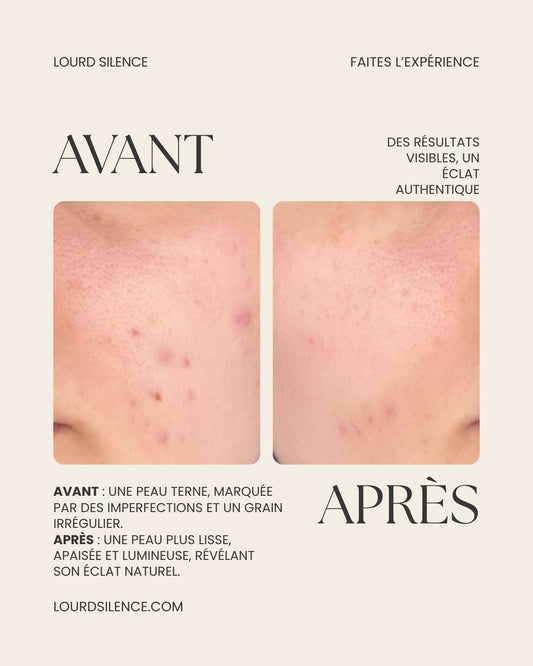 Prenez Soin de Votre Peau : Nos Conseils Indispensables !