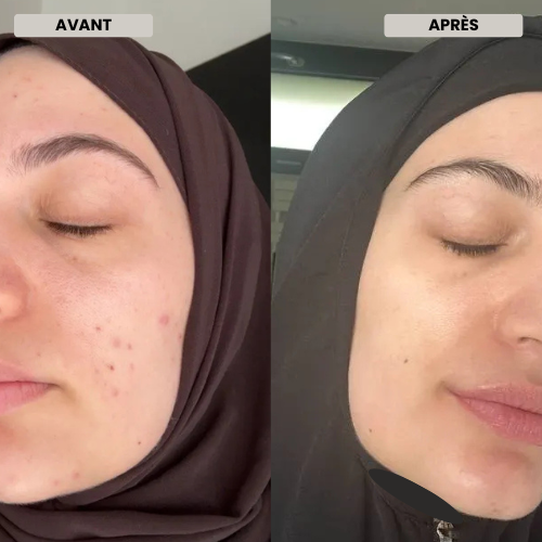 SkinCare Complète – Peau Éclatante Apaisée et Naturelle